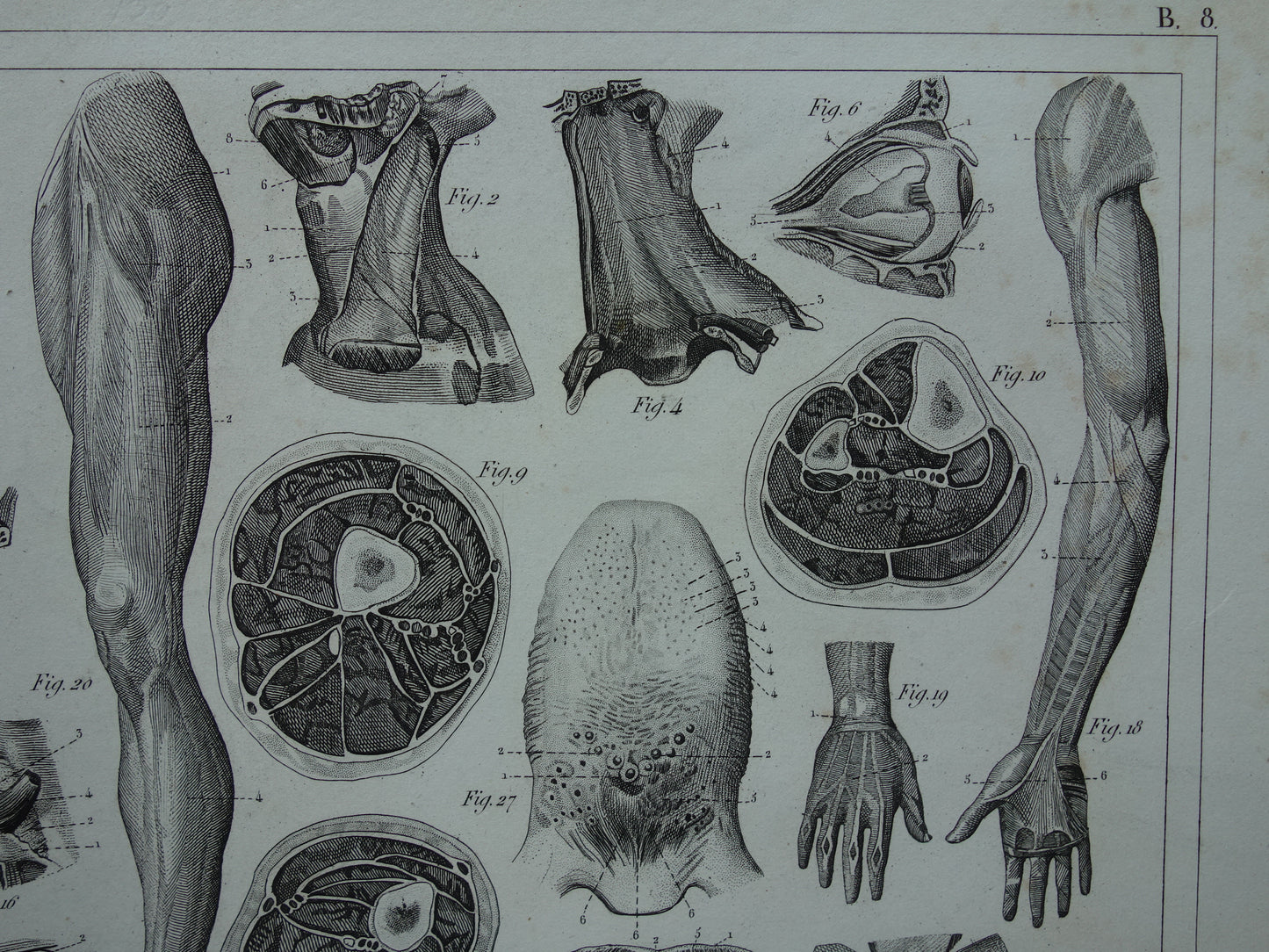 Antiker Anatomiedruck von 1849 mit Bildern von Arm-, Hand-, Bein- und Fußmuskeln alter Druckmyologie