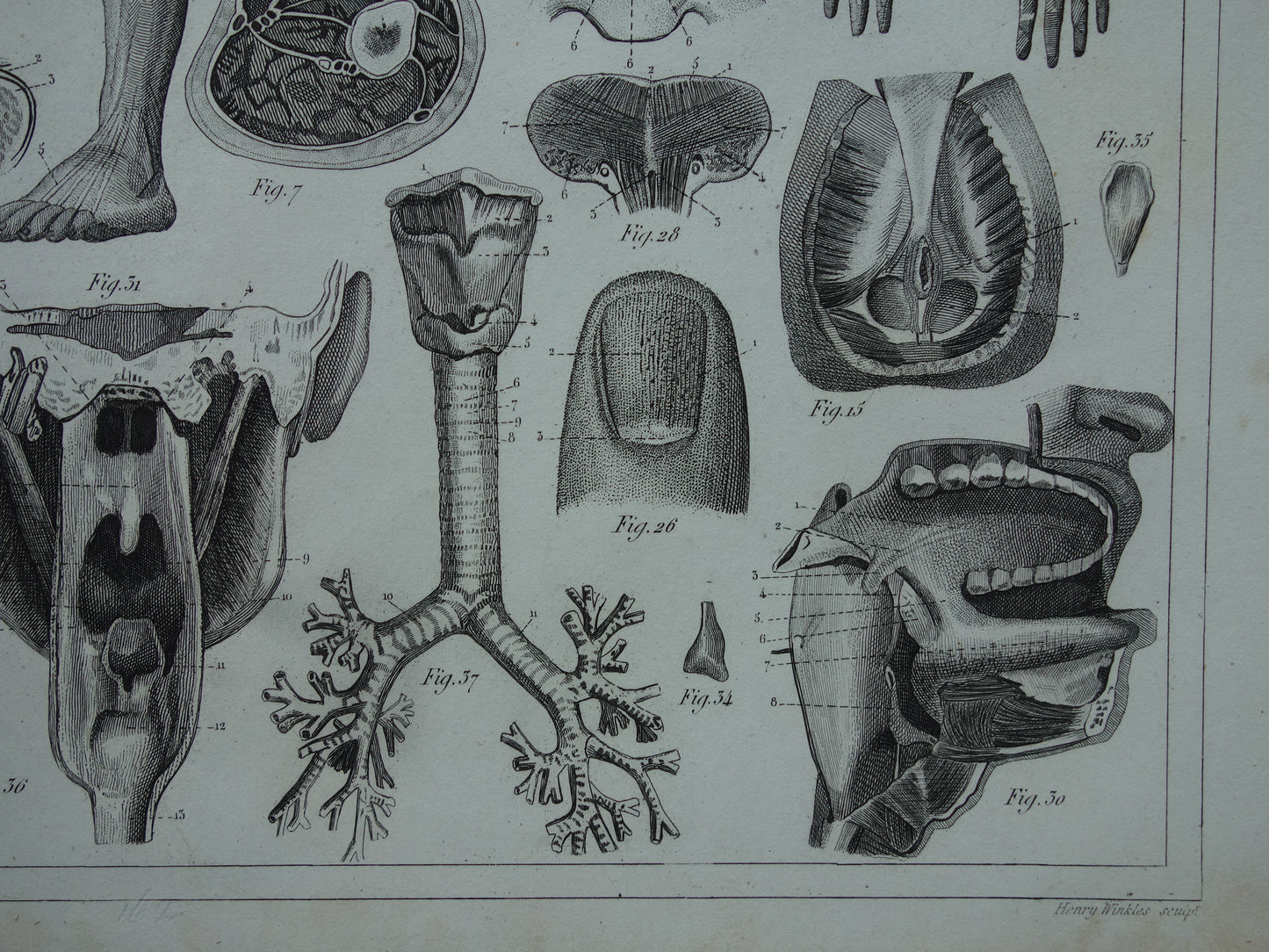 Antiker Anatomiedruck von 1849 mit Bildern von Arm-, Hand-, Bein- und Fußmuskeln alter Druckmyologie