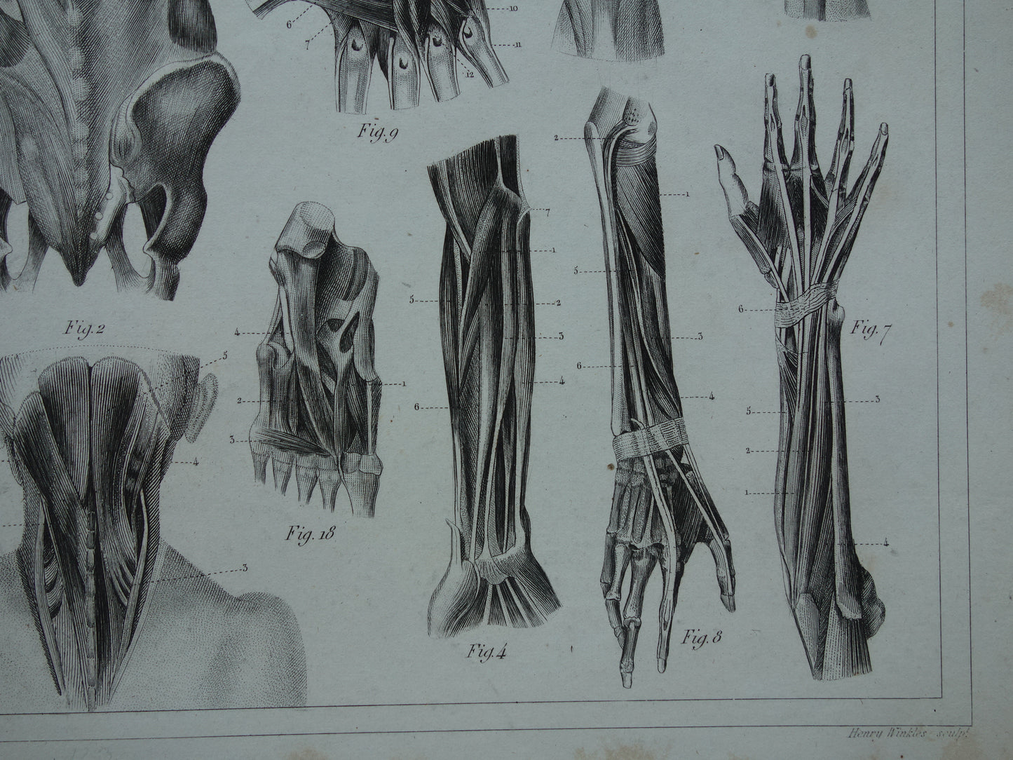 Antieke anatomie prent uit 1849 met afbeeldingen van spieren van arm hand been en voet oude print myologie